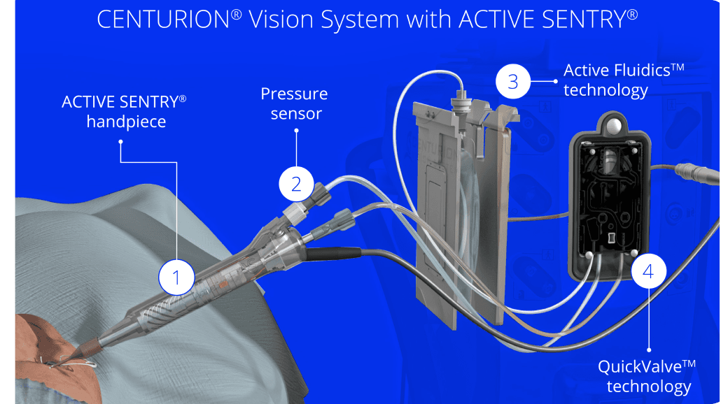Alcon - CENTURION Vision System